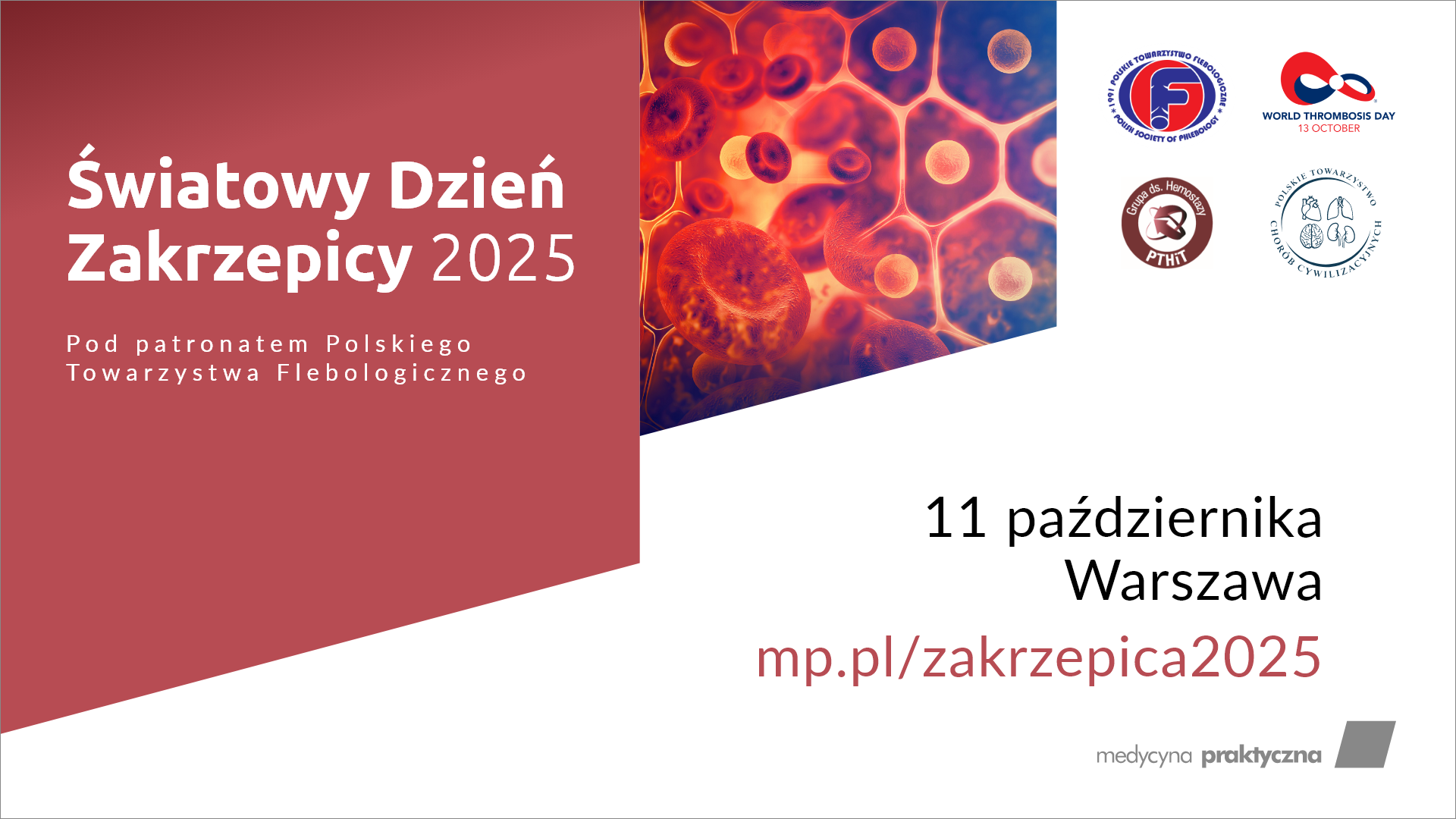 Światowy Dzień Zakrzepicy 2025